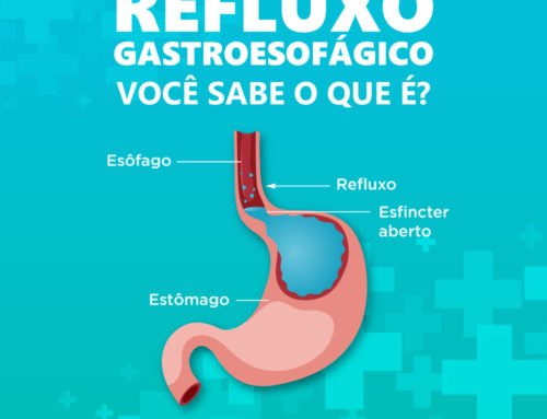 Refluxo Gastroesofágico | Você sabe o que é?